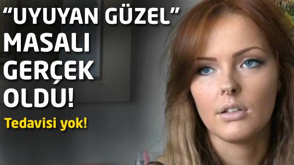 Uyuyan Güzel Sendromu (Klein-Levin Sendromu) Nedir?