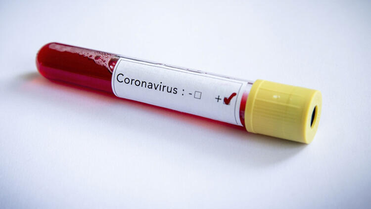 Korona virüs nasıl bulaşır ve anlaşılır?